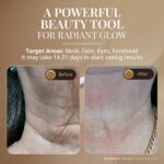A black LED face and neck massager wand with a sleek design, shown with its protective cover and charging cable.